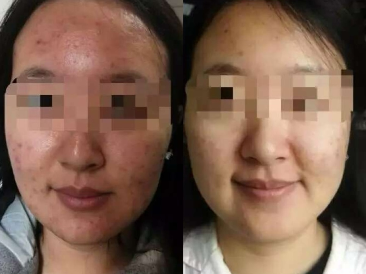 用户反馈照片:案例 1,同一张照片内为使用前与使用后对比。