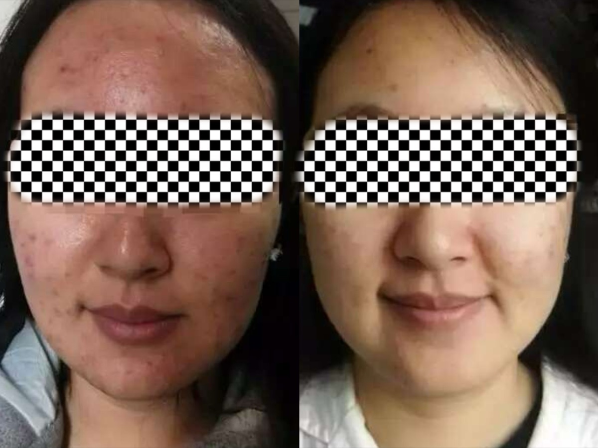 用户反馈照片:案例 2,同一张照片内为使用前与使用后对比。