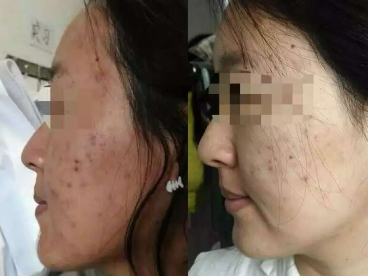 用户反馈照片:案例 3,同一张照片内为使用前与使用后对比。