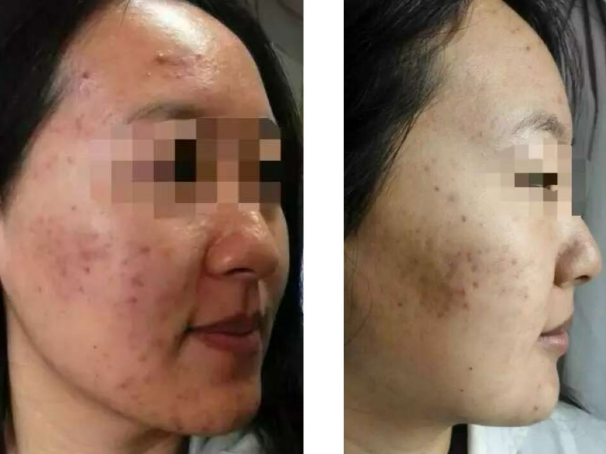 用户反馈照片:案例 5,同一张照片内为使用前与使用后对比。