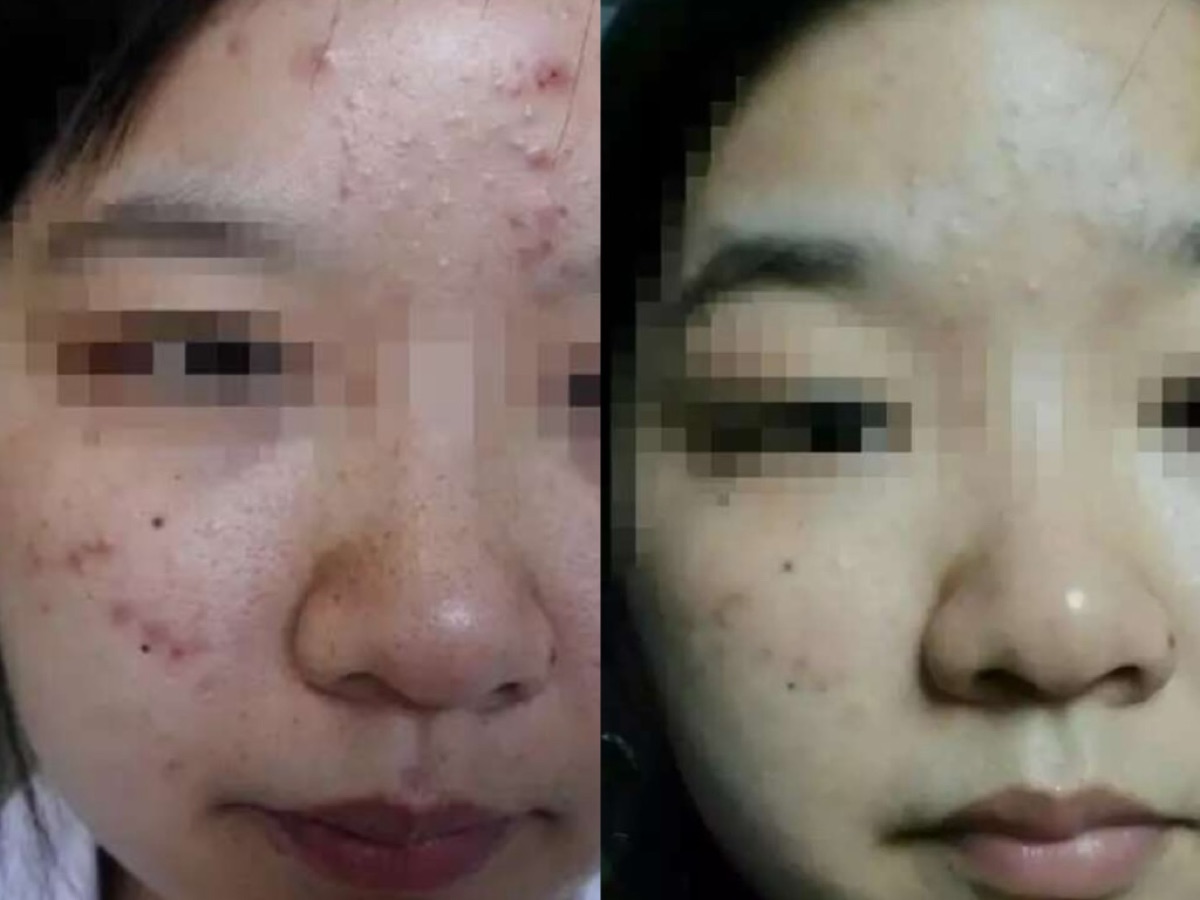 用户反馈照片:案例 6,同一张照片内为使用前与使用后对比。