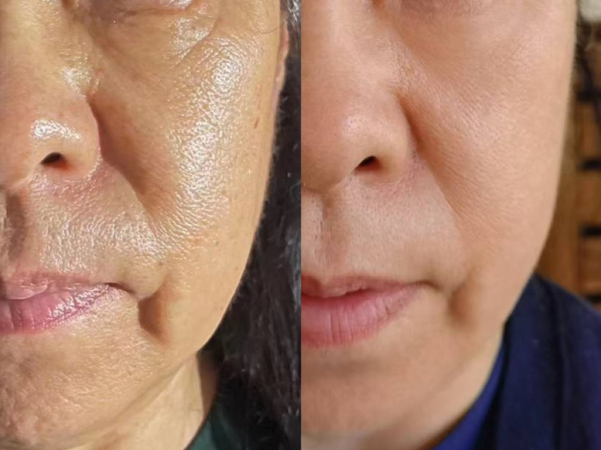 用户反馈照片:案例 2,同一张照片内为使用前与使用后对比。