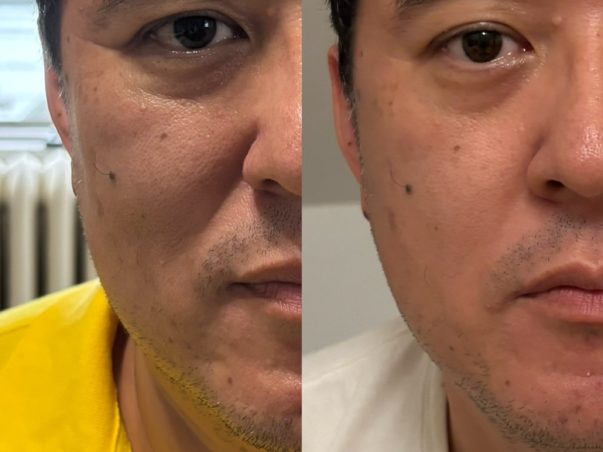 用户反馈照片:案例 3,同一张照片内为使用前与使用后对比。