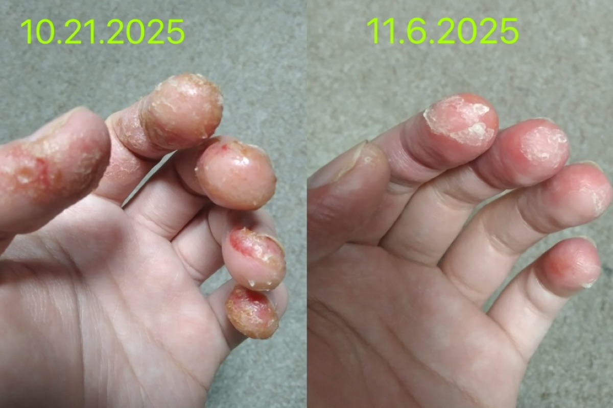 用户反馈照片:案例 1,同一张照片内为使用前与使用后对比。