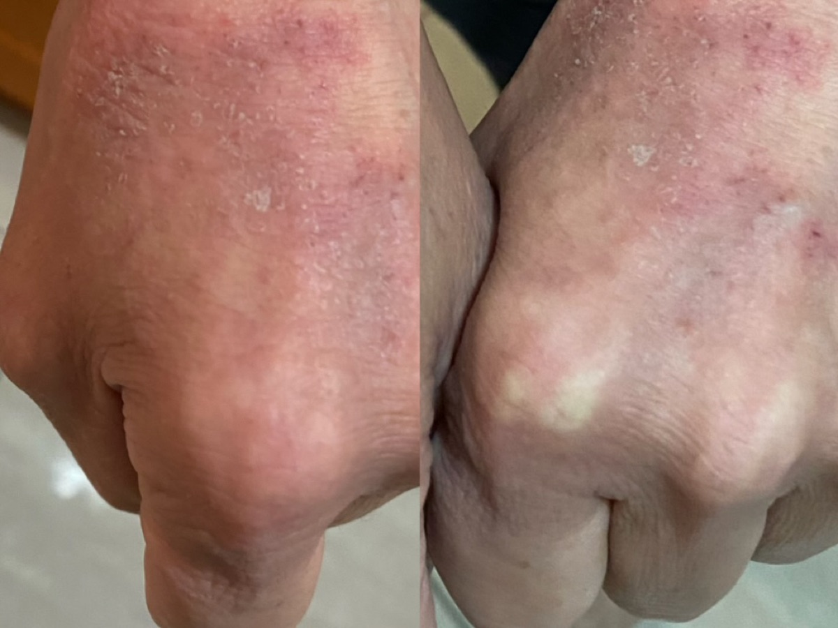 用户反馈照片:案例 3,同一张照片内为使用前与使用后对比。